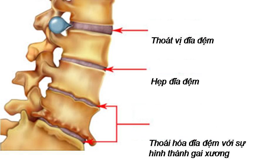 Cột sống con người có bao nhiêu đốt sống?